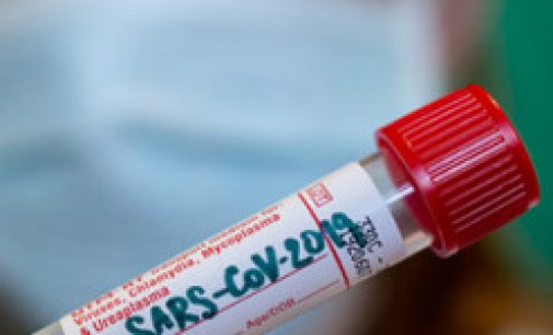 МОЗ Туреччини запустило онлайн-тест на виявлення коронавірусу